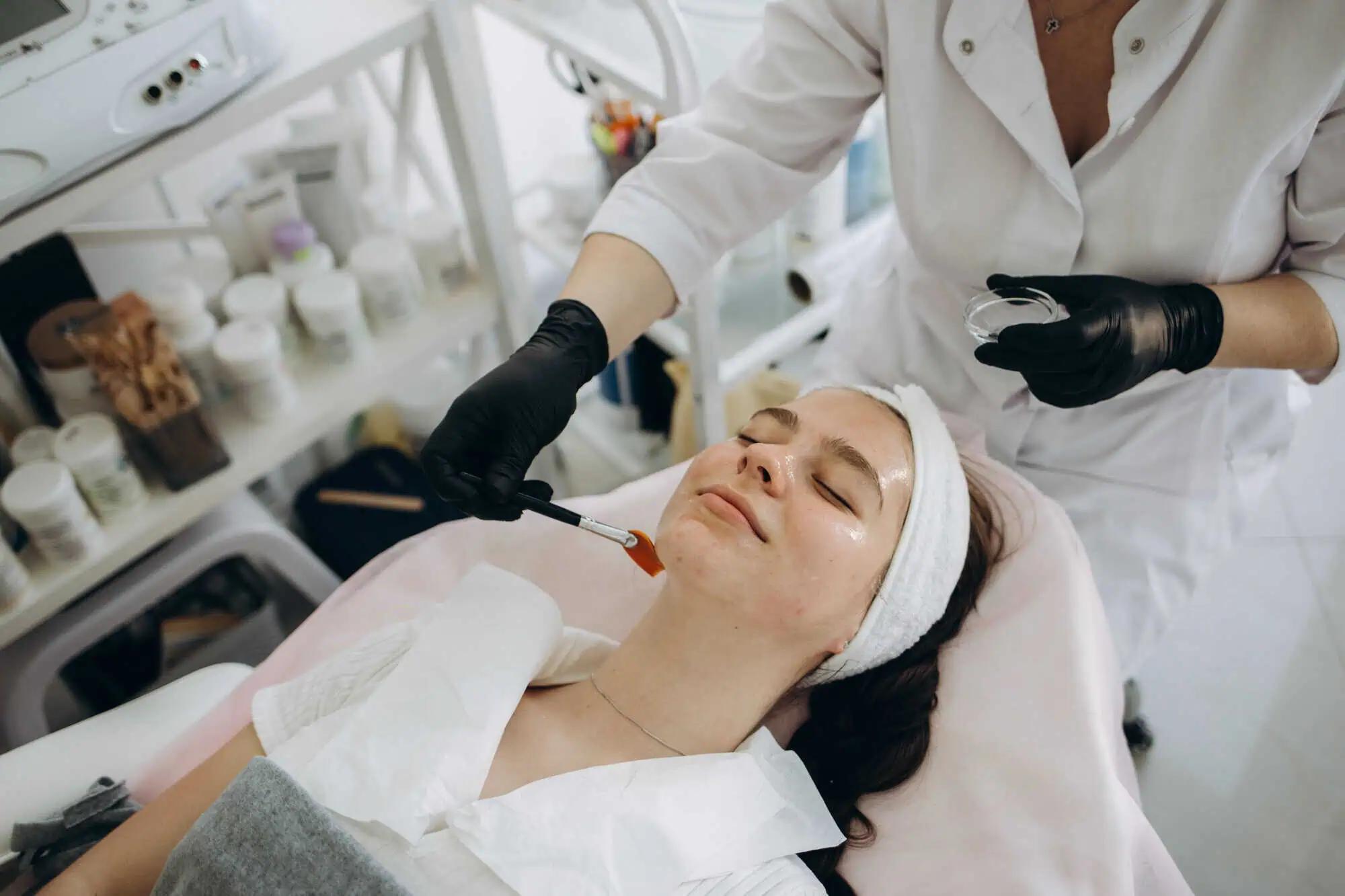 Chemical Peels in Miami: Types, Costs and Recovery