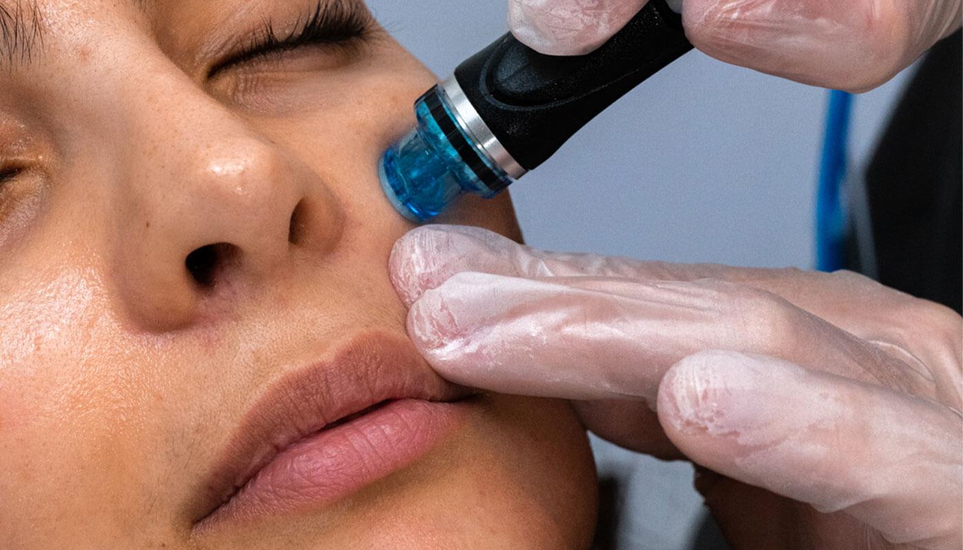 HydraFacial in Tampa: Typical Costs and What to Expect